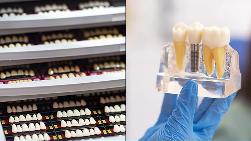 Will Veneers or Crowns Look More Natural?